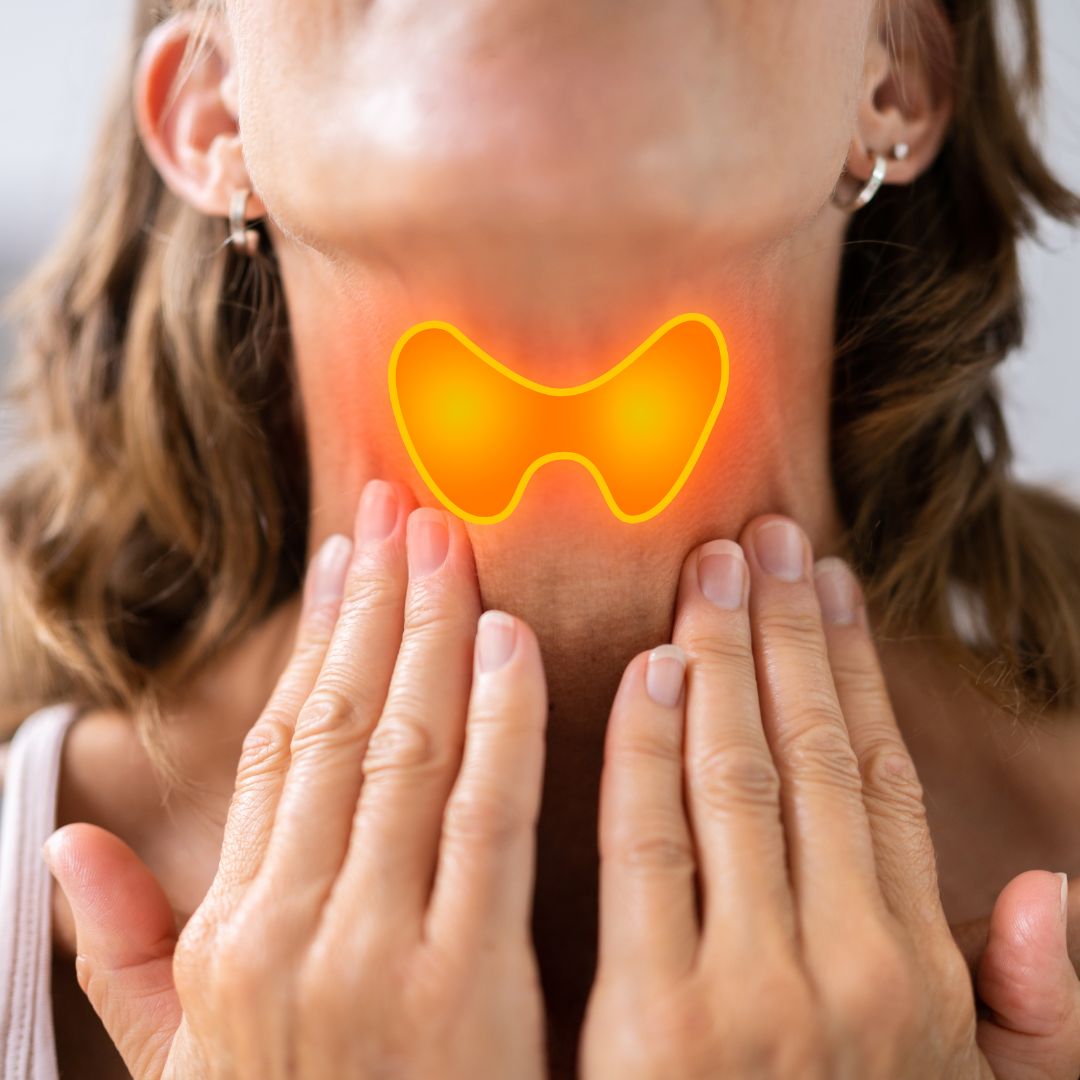 Illustration showing the connection between thyroid hormones and PCOS